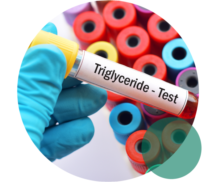 Triglyceride-Test Eine Hand mit blauem Einweghandschuh hält ein Probenröhrchen mit der Aufschrift „Triglyceride-Test“. Dahinter sind die Deckel weiterer Probenröhrchen zu sehen.