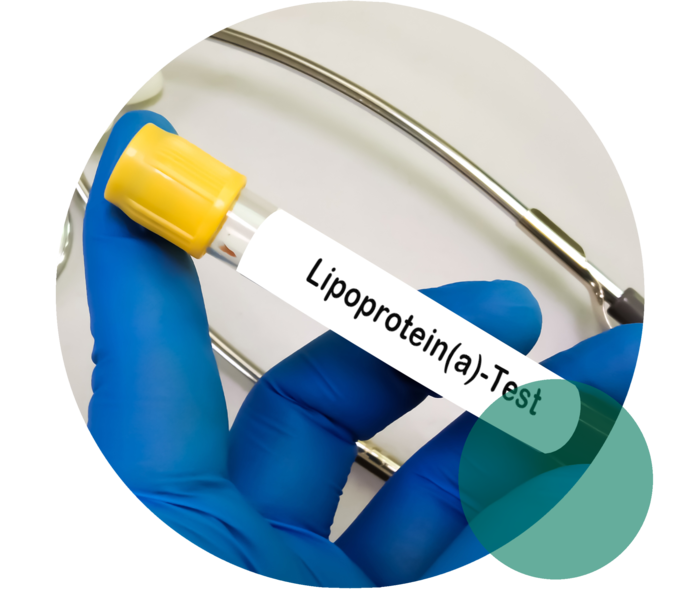 Lipoprotein(a): Blutuntersuchung Eine Hand mit blauem Einweghandschuh hält ein Probenröhrchen mit der Aufschrift „Lipoprotein(a)-Test“.