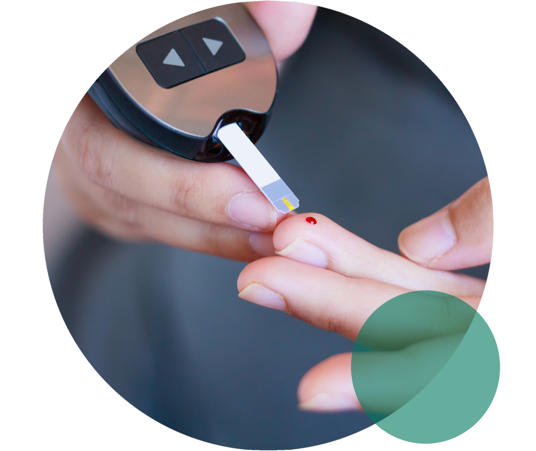Hypercholesterinämie und Diabetes mellitus Hände einer Person. Die rechte Hand hält ein Blutzuckermessgerät mit unbenutztem Teststreifen. Ein Finger der linken Hand wird an den Teststreifen gehalten. An der Fingerkuppe ist eine rötliche Flüssigkeit zu sehen.