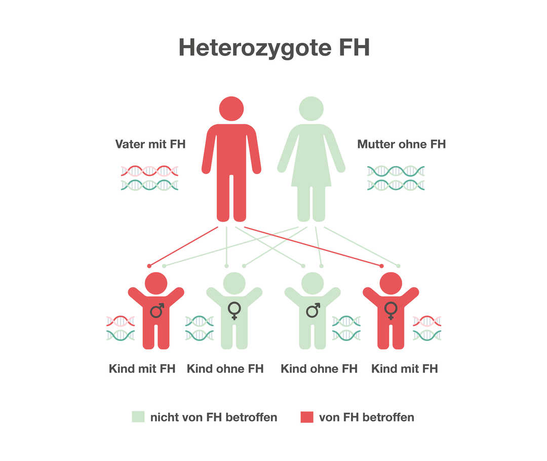 Heterozygote familiäre Hypercholesterinämie Grafik mit der Überschrift „Heterozygote FH“. Sie zeigt, wie die familiäre Hypercholesterinämie vererbt wird. Die familiäre Hypercholesterinämie wird meist nur von einem Elternteil und dominant vererbt, sodass 50 Prozent der Kinder eines betroffenen Elternteils Träger dieser Fettstoffwechselstörung sind.