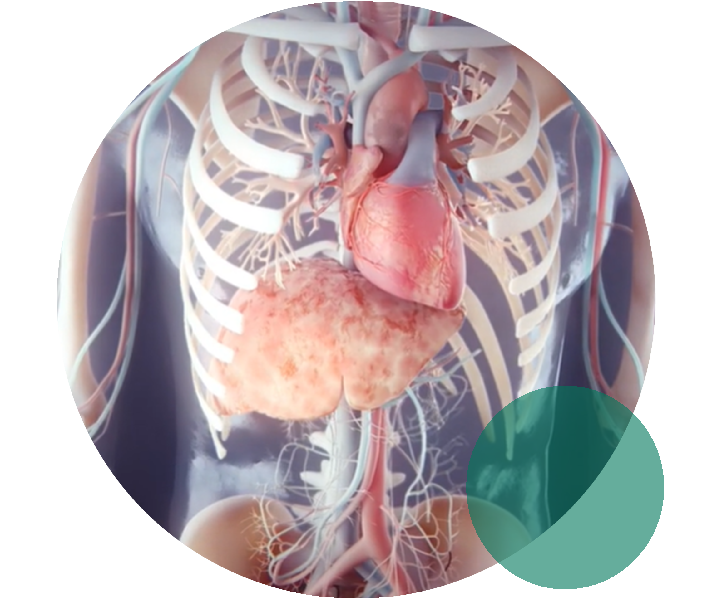 informationsmaterial-zu-lipoprotein-a-lipide-info